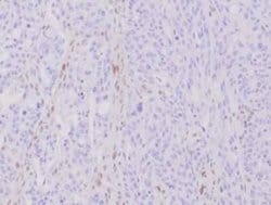 MLH1 Rabbit anti-Human, Clone: MLH1/6284R, Novus Biologicals 20 &mu;g;